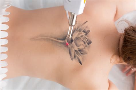 Getting a tattoo while pregnant can also compromise the immune system by inflicting pain, potentially sitting in uncomfortable positions for long periods of time and creating an open wound. Things to Consider While Choosing a Tattoo Removal Service ...