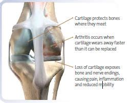Radiation therapy may also be an option. Cat Diseases - Arthritis and Joint Pain | Hill's Pet