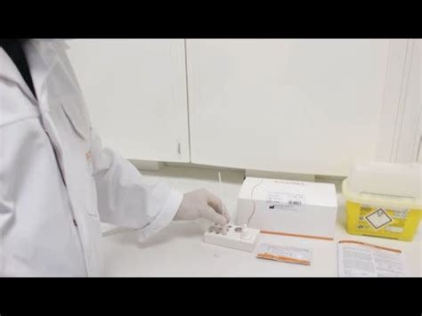 Es wird dem gesammelten patienten ein sofortiges ergebnis. BIOSYNEX COVID 19 BSS Ag Tampone Video Tutorial - YouTube