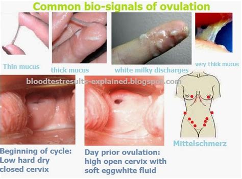 This vaginal white discharge early in pregnancy is often if you're not pregnant, white vaginal discharge can also indicate ovulation. Before I Find Out That Im Pregnant Will I Have A Fever ...