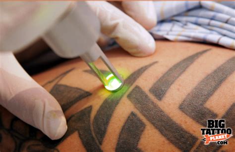 Laser Tattoo Removal Near Me - Tattoo | Big Tattoo Planet Saline tattoo removal beauty blade aesthetics microblading.