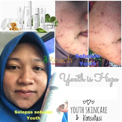 Yuk simak contoh ucapan pada artikel berikut ini, siapa tahu bisa ia tak pernah menganggap hari kelahirannya spesial. Testimoni Youth Skincare Shaklee Selamat Untuk Ibu ...